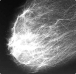 Маммограф МЭМ 20-08