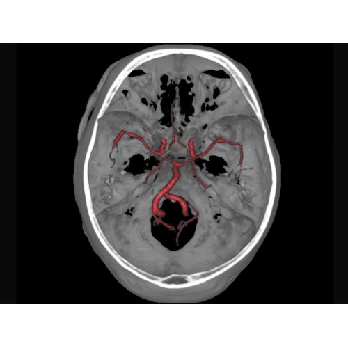 КТ аппарат GE Brivo CT385